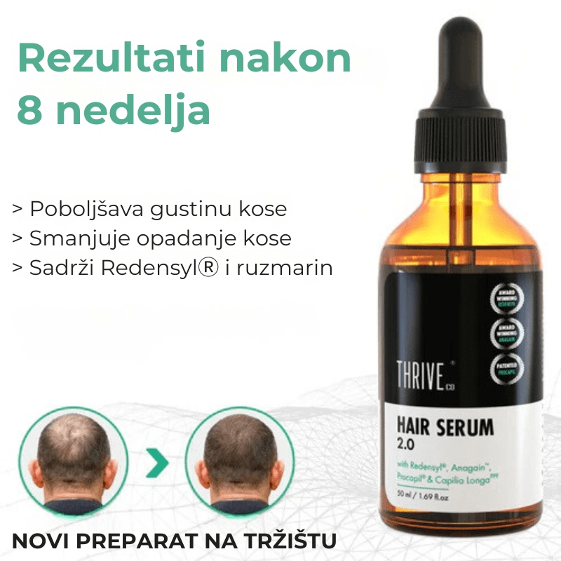 Serum protiv opadanja kose Trive - Na Klik